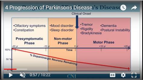 parkinson's disease stages timeline